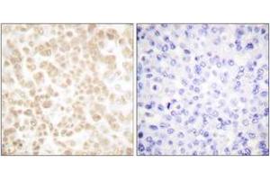 Immunohistochemistry (IHC) image for anti-FOS-Like Antigen 2 (FOSL2) (AA 271-320) antibody (ABIN2889199) (FOSL2 Antikörper  (AA 271-320))