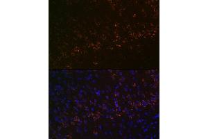 Immunofluorescence analysis of mouse brain using Huntingtin Rabbit mAb (ABIN7267793) at dilution of 1:100 (40x lens). (Huntingtin Antikörper)