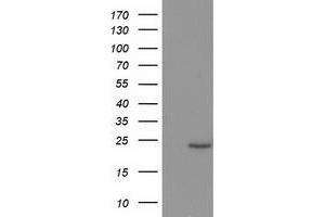 Western Blotting (WB) image for anti-Suppressor of Cytokine Signaling 3 (SOCS3) antibody (ABIN1501059)