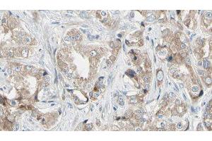 ABIN6279042 at 1/100 staining Human prostate tissue by IHC-P. (RPL24 Antikörper  (Internal Region))