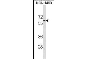 PGM5 Antibody (C-term) (ABIN1537280 and ABIN2849179) western blot analysis in NCI- cell line lysates (35 μg/lane).
