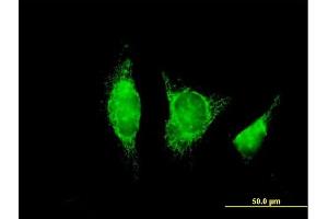Immunofluorescence of purified MaxPab antibody to ADH1B on HeLa cell. (ADH1B Antikörper  (AA 1-375))