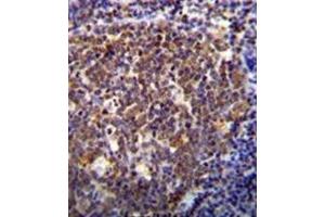 Immunohistochemistry analysis in formalin fixed and paraffin embedded human tonsil tissue reacted with HOXB6 / HOX2B Antibody (Center) followed  which was peroxidase-conjugated to the secondary antibody, followed by DAB staining. (HOXB6 Antikörper  (Middle Region))