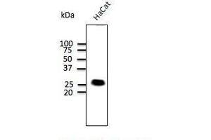 Anti-Calnexin Ab at 1/500 dilution, lysates at 50 per Iane, rabbit polyclonal to goat lµg (HRP) at 1/10,000 dilution, (Caveolin-1 Antikörper  (N-Term))