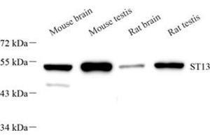 Western blot analysis of ST13 (ABIN7075761),at dilution of 1: 2000 (HSC70 Interacting Protein HIP Antikörper)
