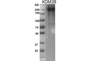 Western Blotting (WB) image for Lysine (K)-Specific Demethylase 2B (KDM2B) protein (DYKDDDDK Tag) (ABIN2669703)