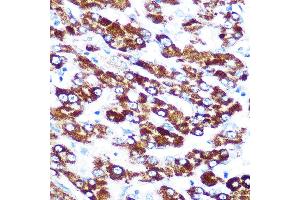 Immunohistochemistry of paraffin-embedded human liver using SERPINC1 Rabbit mAb (ABIN7270208) at dilution of 1:100 (40x lens). (SERPINC1 Antikörper)