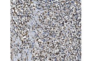 IHC analysis of CDC27 using anti-CDC27 antibody (ABIN7602163). (CDC27 Antikörper  (AA 609-824))