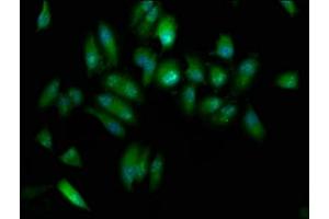 Immunofluorescence (IF) image for anti-Elongator complex protein 3 (ELP3) (AA 1-85) antibody (ABIN7151580)