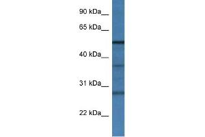 WB Suggested Anti-Rnf14 Antibody   Titration: 1. (RNF14 Antikörper  (N-Term))