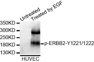 Western blot analysis of extracts of HUVEC cell line, using Phospho-ERBB2-Y1221/1222 antibody. (ErbB2/Her2 Antikörper  (pTyr1221, pTyr1222))