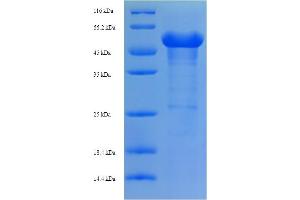SDS-PAGE (SDS) image for Aminoadipate Aminotransferase (AADAT) (AA 30-425) protein (His-SUMO Tag) (ABIN5711616)