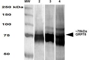 Western Blot analysis of Human, Mouse, Rat HEK-293, NIH3T3, and Rat Brain cell lysates showing detection of GRP78 protein using Mouse Anti-GRP78 Monoclonal Antibody, Clone 3G12-1G11 . (GRP78 Antikörper  (PE))