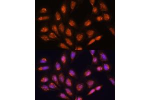 Immunofluorescence analysis of U-2 OS cells using TIMM44 antibody (ABIN7270927) at dilution of 1:100. (TIMM44 Antikörper  (AA 153-452))