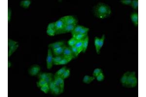 Immunofluorescence staining of HepG2 cells with ABIN7170211 at 1:133, counter-stained with DAPI. (SLC26A6 Antikörper  (AA 554-668))