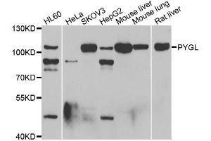 Western blot analysis of extracts of various cell lines, using PYGL antibody. (PYGL Antikörper  (AA 1-280))