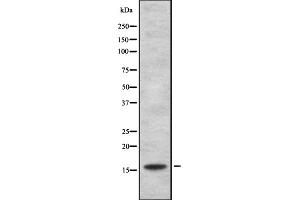 Western blot analysis of HSPB3 expression in HEK293 cells ,The lane on the left is treated with the antigen-specific peptide. (HSPB3 Antikörper  (Internal Region))