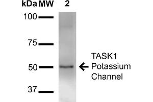 Western Blot analysis of Rat Brain Membrane showing detection of ~50 kDa TASK1 Potassium Channel protein using Mouse Anti-TASK1 Potassium Channel Monoclonal Antibody, Clone S374-48 . (KCNK3 Antikörper  (AA 251-411) (FITC))