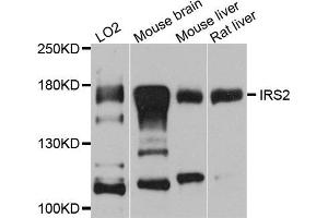 Western blot analysis of extracts of various cell lines, using IRS2 antibody (ABIN5974770) at 1/1000 dilution.