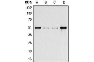 Western blot analysis of Beta-arrestin-1 (pS412) expression in HeLa (A), HEK293T (B), Raw264. (beta Arrestin 1 Antikörper  (C-Term, pSer412))