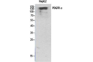 Western Blot (WB) analysis of specific cells using PDGFR-alpha Polyclonal Antibody.