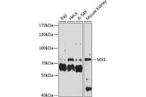 Western blot analysis of extracts of various cell lines, using MX1 antibody (ABIN3022532, ABIN3022533, ABIN3022534 and ABIN6218886) at 1:3000 dilution. (MX1 Antikörper  (AA 368-662))