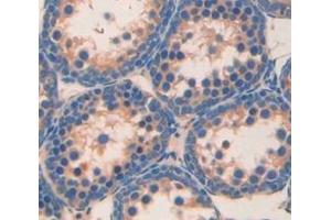 IHC-P analysis of Mouse Tissue, with DAB staining. (Angiotensin I Converting Enzyme 1 Antikörper  (AA 504-597))