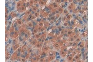 DAB staining on IHC-P; Samples: Rat Intestine Tissue (KIT Ligand Antikörper  (AA 27-259))