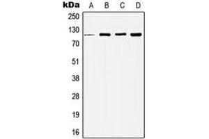 Western blot analysis of Histone Deacetylase 5 expression in MCF7 (A), HeLa (B), NIH3T3 (C), H9C2 (D) whole cell lysates.