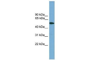 TMPRSS4 antibody used at 1 ug/ml to detect target protein.
