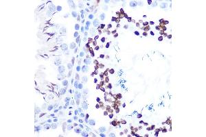 Immunohistochemistry of paraffin-embedded rat testis using Phospho-ST-S727 Rabbit mAb (ABIN7270300) at dilution of 1:100 (40x lens). (STAT1 Antikörper  (pSer727))