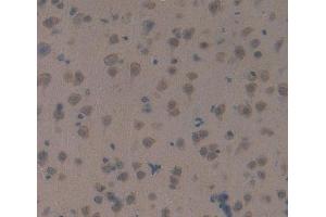 IHC-P analysis of brain tissue, with DAB staining. (MAP1B Antikörper  (AA 2203-2464))