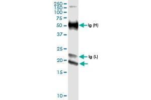 Immunoprecipitation of IFNE transfected lysate using anti-IFNE MaxPab rabbit polyclonal antibody and Protein A Magnetic Bead , and immunoblotted with IFNE MaxPab rabbit polyclonal antibody (D01) . (IFNE Antikörper  (AA 1-208))
