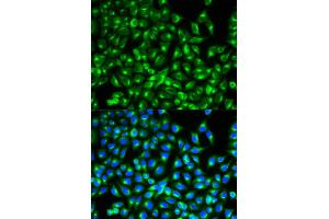 Immunofluorescence analysis of MCF-7 cells using CDC34 antibody. (CDC34 Antikörper)