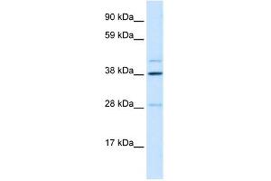 WB Suggested Anti-LASS3 Antibody Titration: 0. (LASS3 Antikörper  (N-Term))
