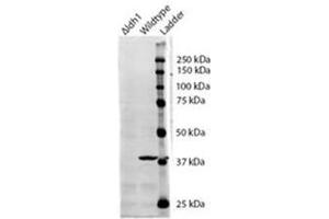 AP31099PU-N IDH1 antibody staining of S. (IDH1 Antikörper  (Internal Region))