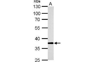 Western Blotting (WB) image for anti-Aldo-Keto Reductase Family 1, Member B10 (Aldose Reductase) (AKR1B10) antibody (ABIN2856687)