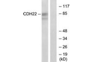 Western Blotting (WB) image for anti-Cadherin-Like 22 (CDH22) (AA 111-160) antibody (ABIN2889882) (CDH22 Antikörper  (AA 111-160))