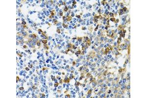 Immunohistochemistry of paraffin-embedded Human tonsil using HYOU1 Polyclonal Antibody at dilution of 1:100 (40x lens). (HYOU1 Antikörper)