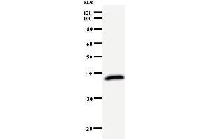 Western Blotting (WB) image for anti-RuvB-Like 1 (E. Coli) (RUVBL1) antibody (ABIN932457) (RUVBL1 Antikörper)