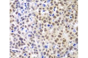Immunohistochemistry of paraffin-embedded Mouse cancer using LHX4 Polyclonal Antibody at dilution of 1:100 (40x lens). (LHX4 Antikörper)