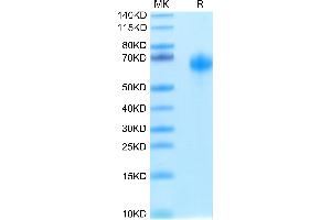 IL1RAP Protein (His-Avi Tag,Biotin)