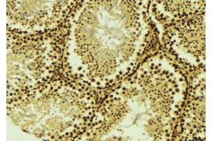 ABIN6275529 at 1/100 staining Mouse testis tissue by IHC-P. (STK36 Antikörper  (Internal Region))