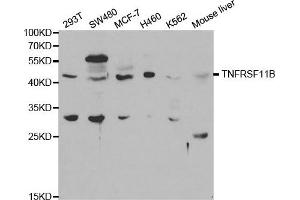 Western blot analysis of extracts of various cell lines, using TNFRSF11B antibody. (Osteoprotegerin Antikörper)