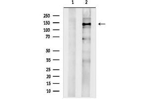 anti-Ubiquitin Specific Peptidase 31 (USP31) (N-Term) antibody