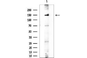 anti-DEAH (Asp-Glu-Ala-His) Box Polypeptide 8 (DHX8) (C-Term) antibody