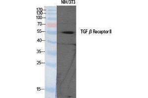 Western Blotting (WB) image for anti-Transforming Growth Factor, beta Receptor II (70/80kDa) (TGFBR2) (Tyr159) antibody (ABIN3187247)
