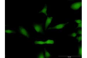 Immunofluorescence of purified MaxPab antibody to CCND1 on HeLa cell. (Cyclin D1 Antikörper  (AA 1-295))