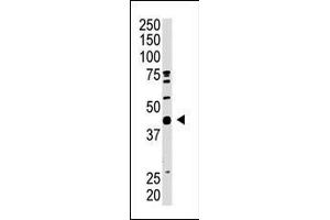 SAE1 Antikörper  (C-Term)