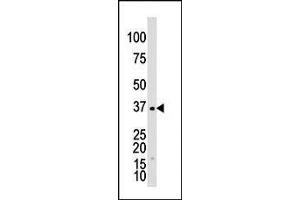 The anti-GALK1 Pab (ABIN391114 and ABIN2841244) is used in Western blot to detect GALK1 in Y79 cell lysate. (GALK1 Antikörper  (C-Term))